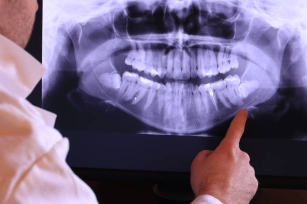 Best Emergency TMJ Treatment in Pacifi, CA