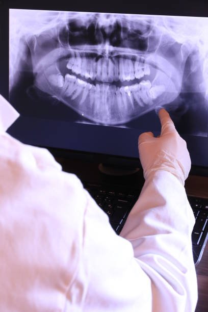 Best Emergency Dental Care for Broken or Chipped Teeth in Pacifi, CA