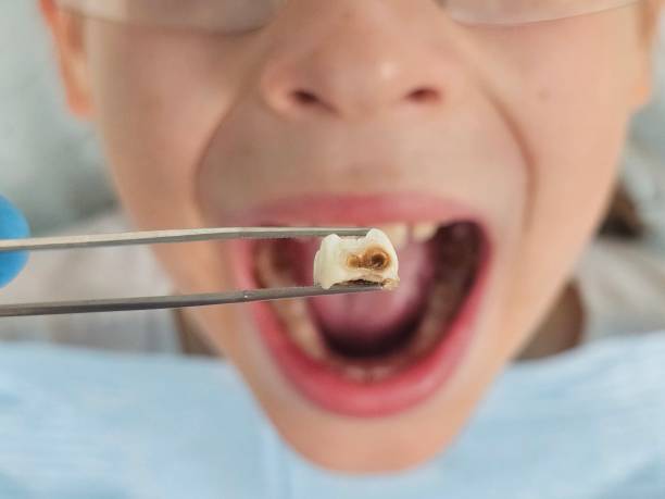 Best Cosmetic Emergency Dentistry in Pacifi, CA